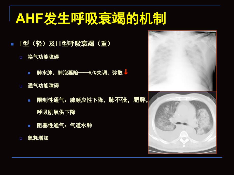 急性心力衰竭ahf的无创正压通气詹庆元课件幻灯PPT文档资料_第1页