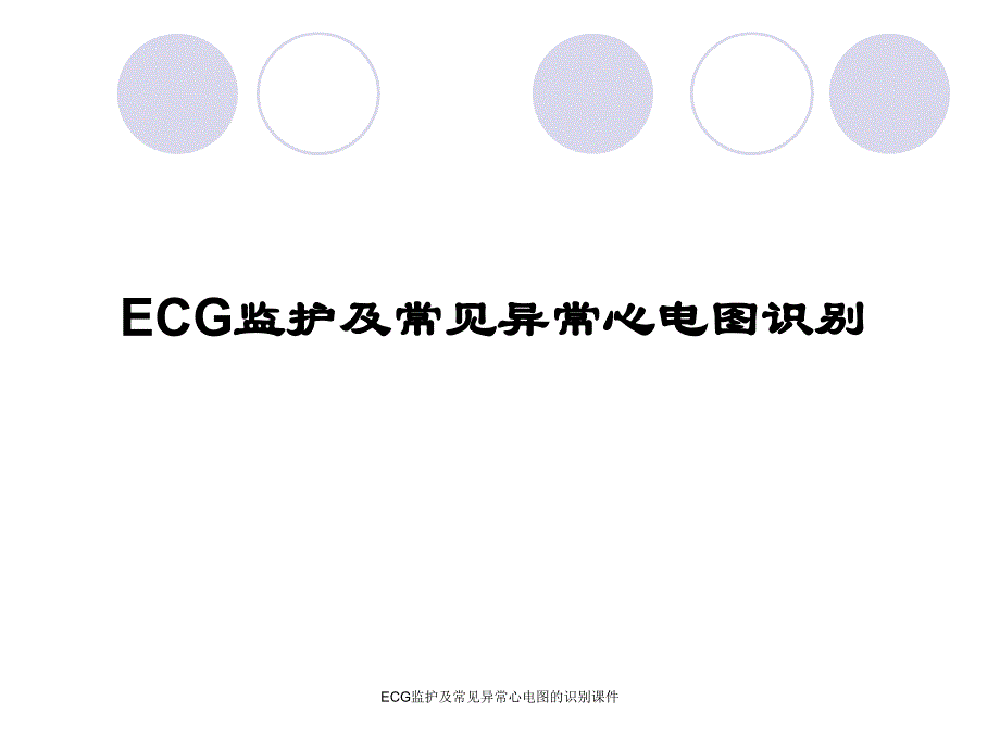 ECG监护及常见异常心电图的识别课件_第1页