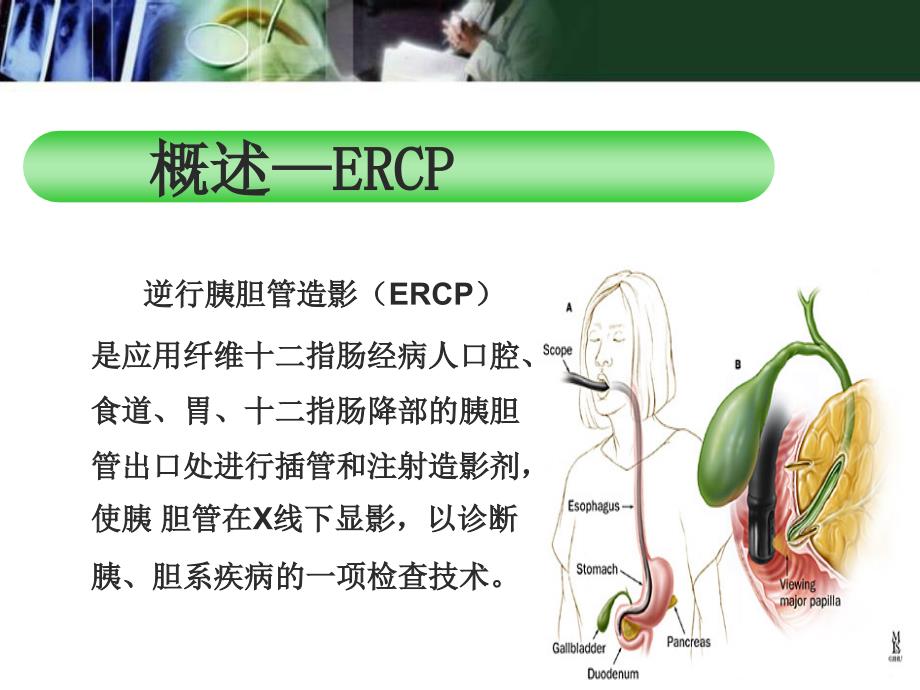 ERCP及术前术后护理课件_第3页