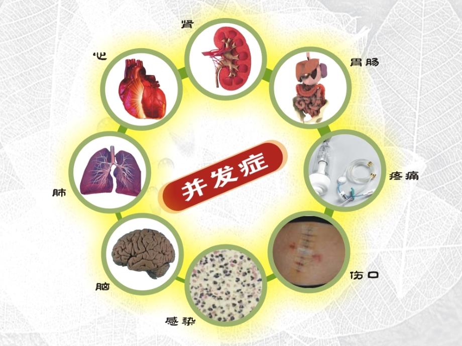 金马液体治疗与手术预后_第3页