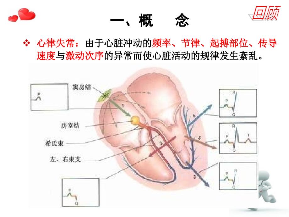 心律失常风险评估与护理对策_第3页