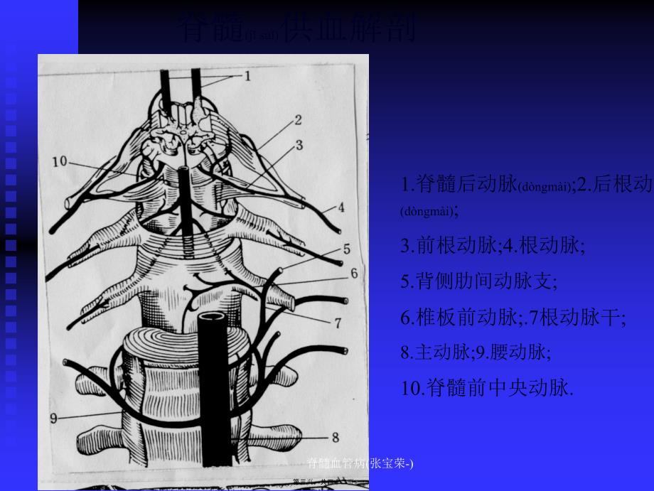 脊髓血管病(张宝荣-)课件_第3页