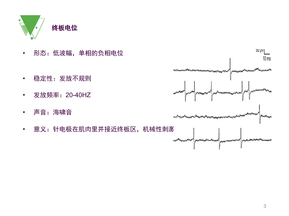 肌电图基础知识之电位分析ppt课件_第3页