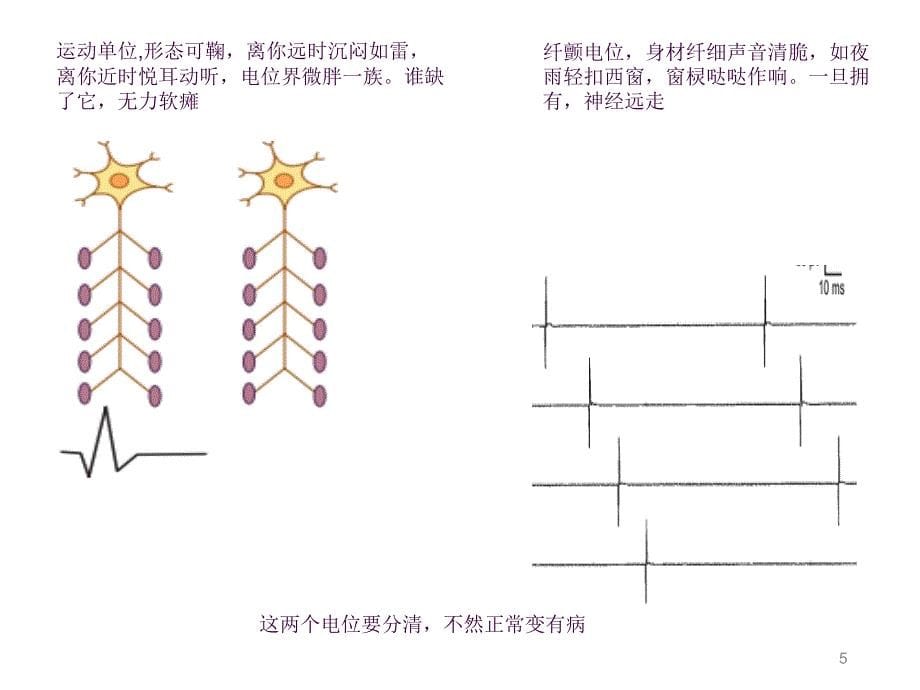 肌电图基础知识之电位分析ppt课件_第5页