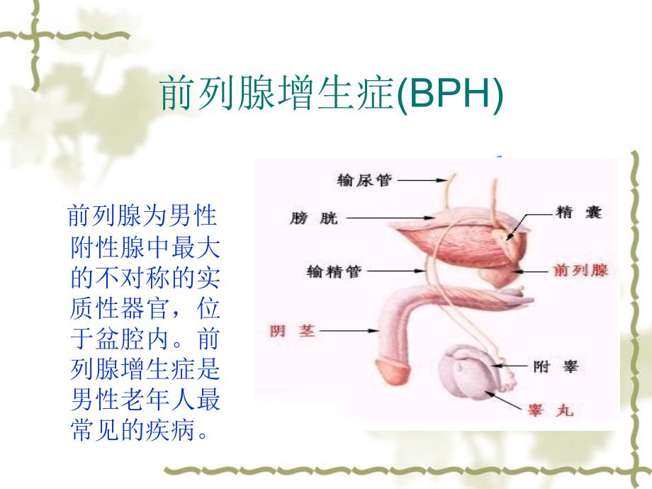 前列腺增生症_第2页