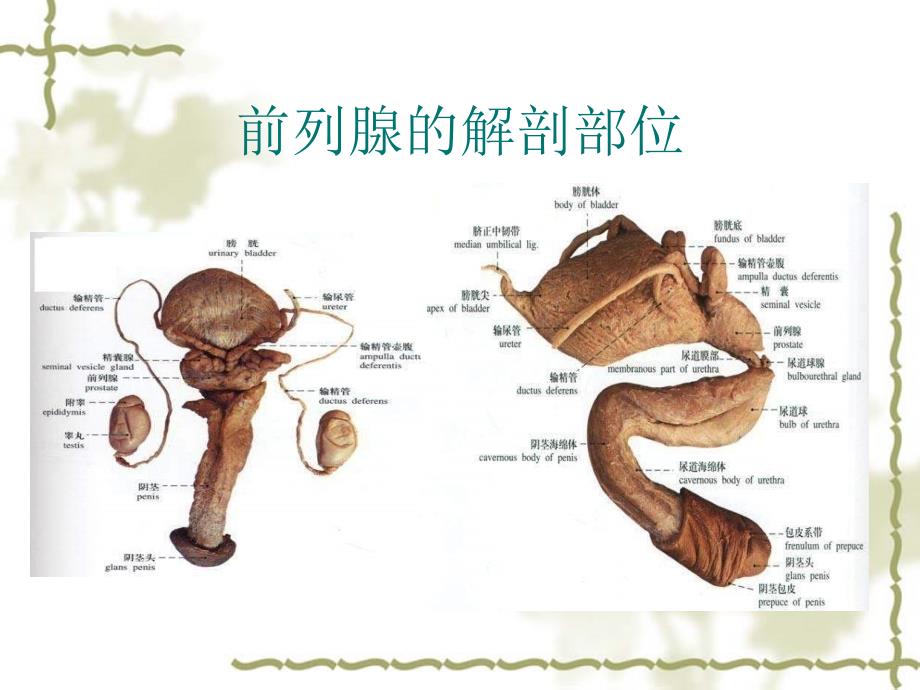 前列腺增生症_第3页