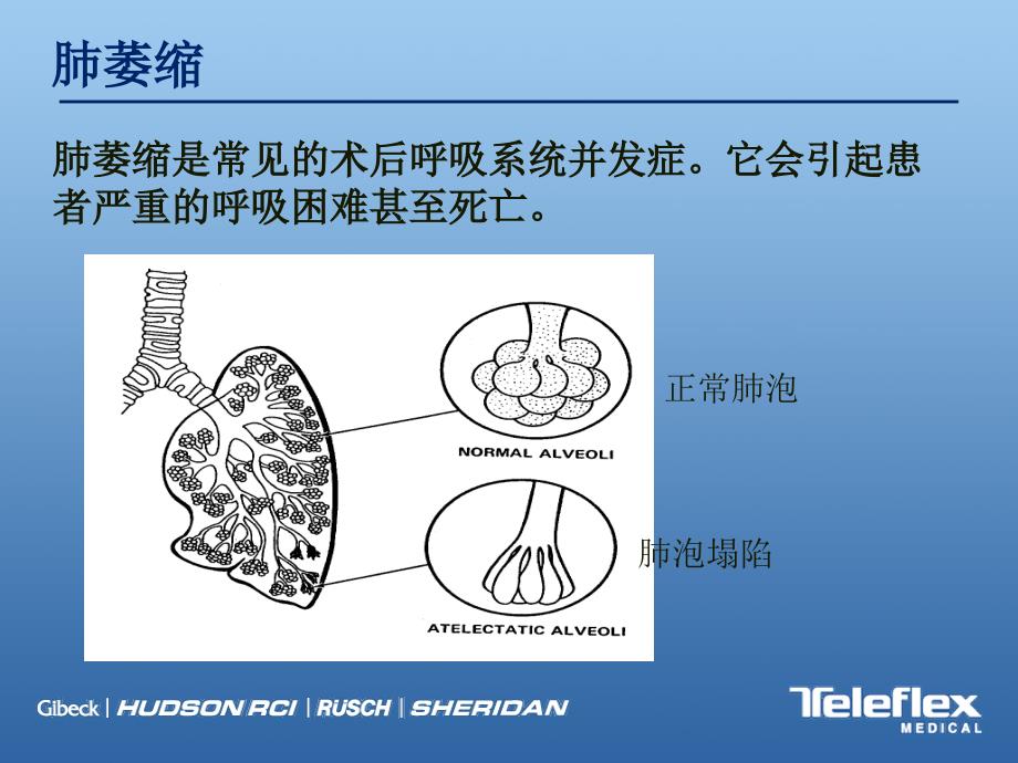 肺萎缩与深呼吸训练器_第2页