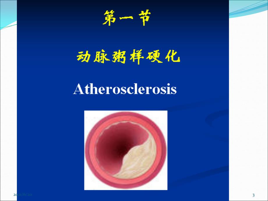 动脉粥样硬化和高血压（106页）_第3页