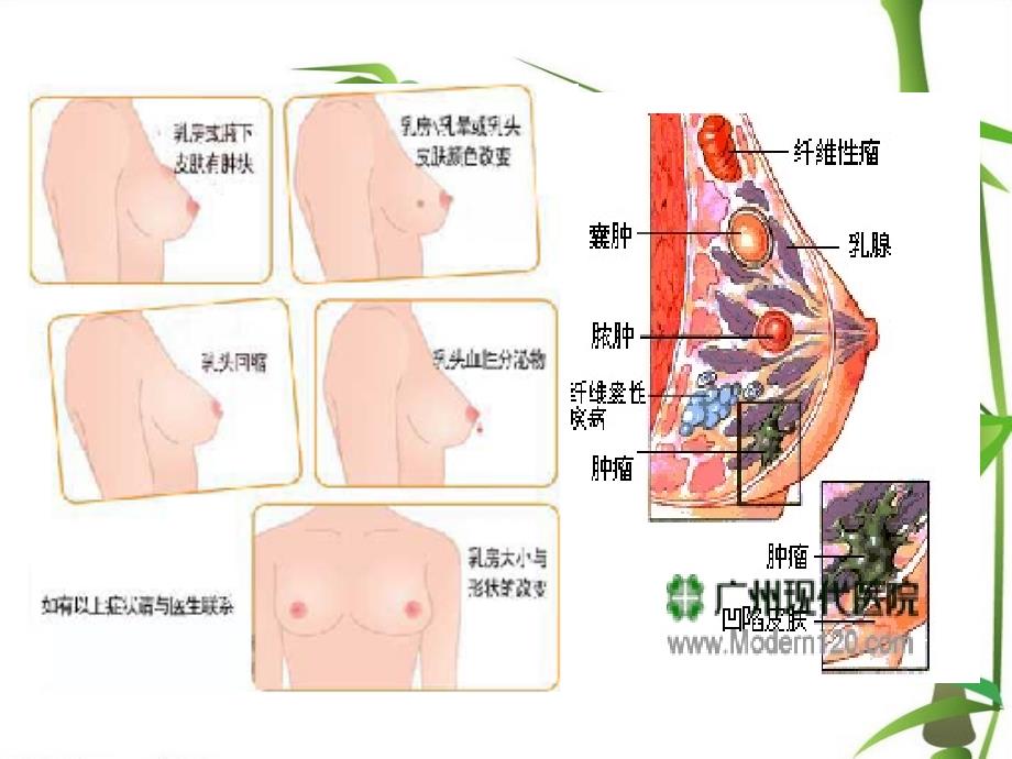 最新：女性保养胸和卵巢文档资料_第4页