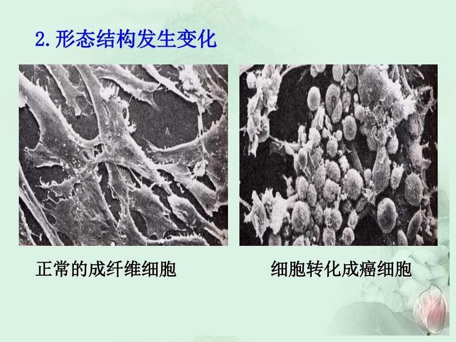 癌细胞的主要特征.ppt_第5页