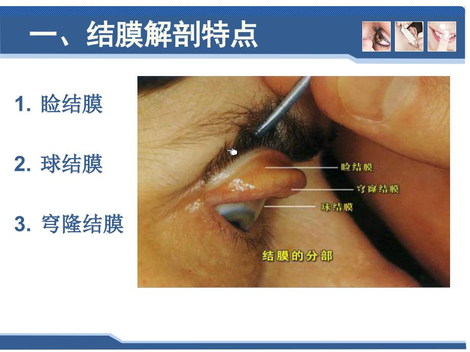 五官科学第三章眼科常见疾病2结膜病一结膜炎_第3页