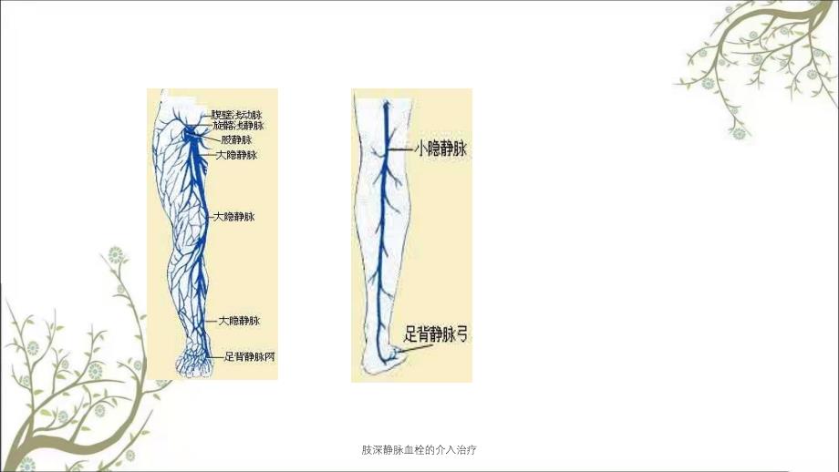 肢深静脉血栓的介入治疗_第2页