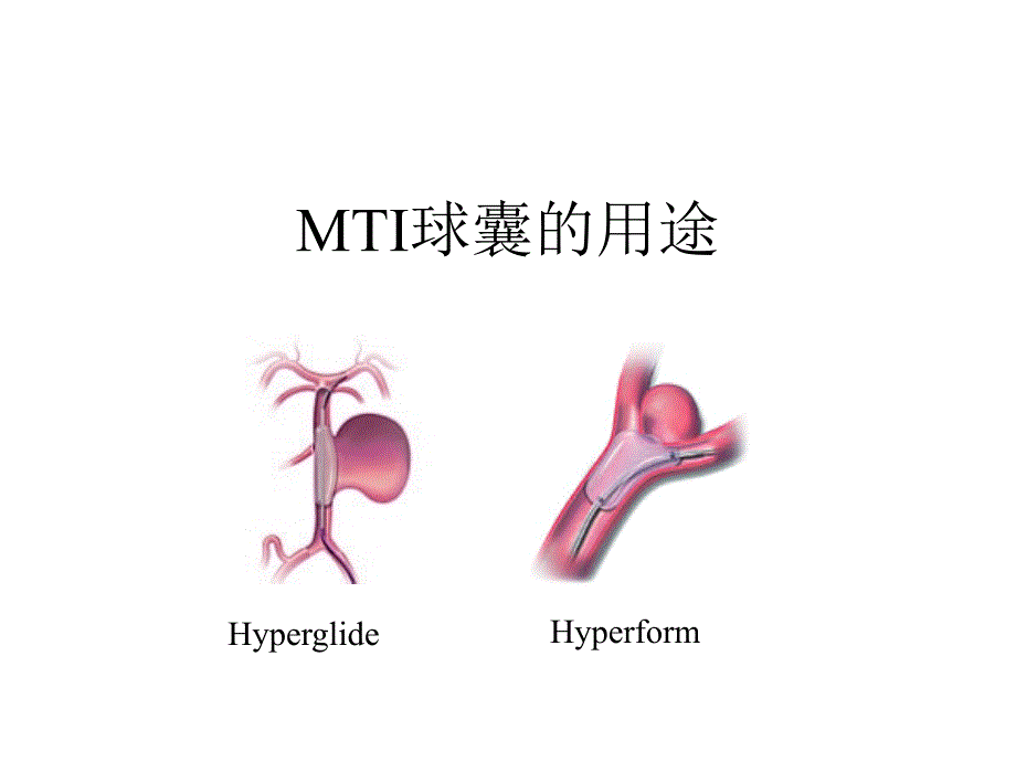 MTI球囊的用途ppt课件_第1页