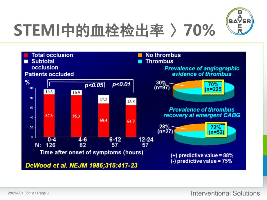 AngioJet产品介绍课堂PPT_第3页