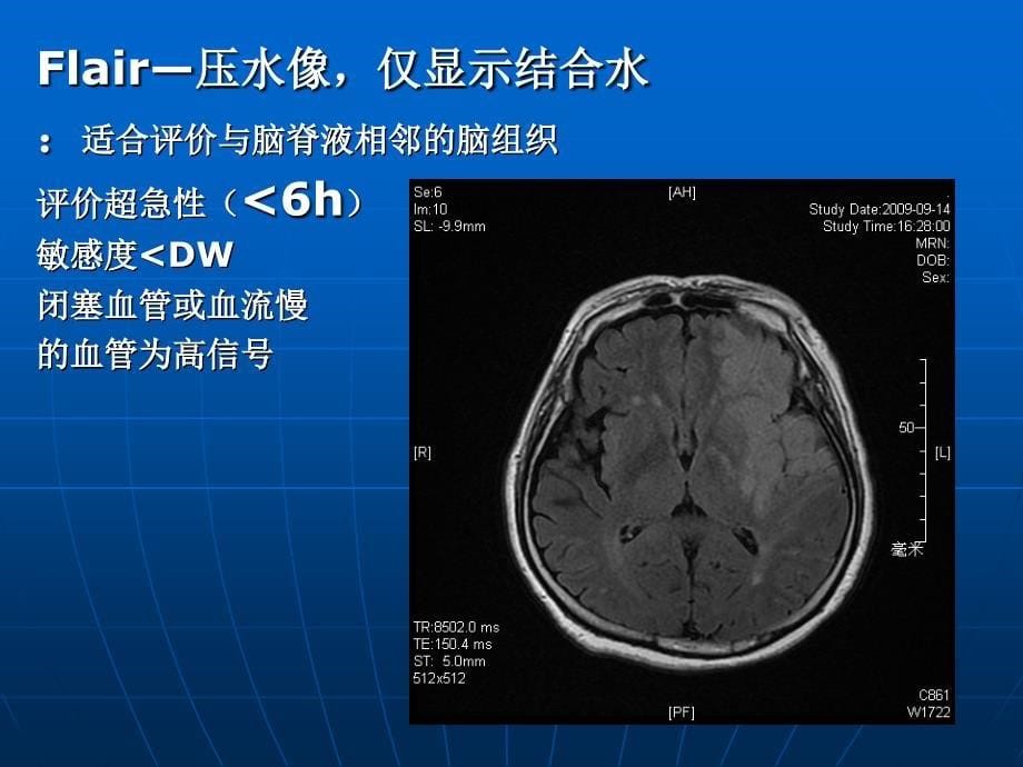 脑部磁共振呈像课件_第5页