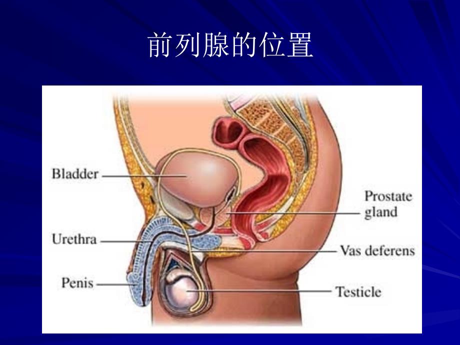 前列腺癌诊断治疗与护理.ppt_第3页