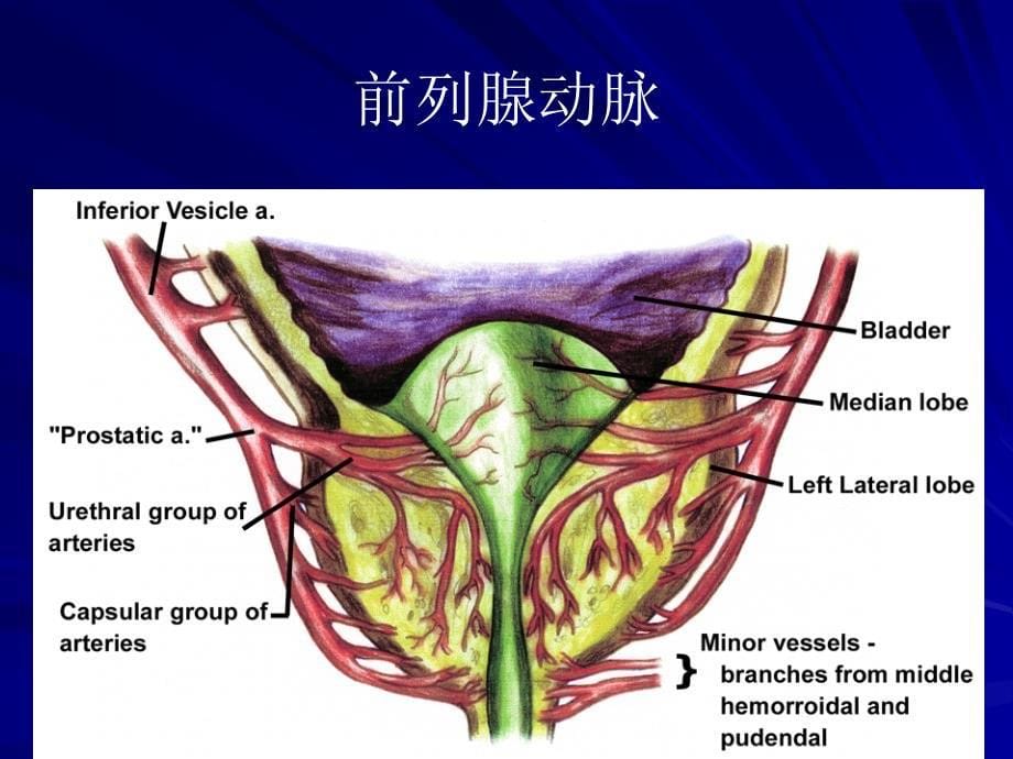 前列腺癌诊断治疗与护理.ppt_第5页