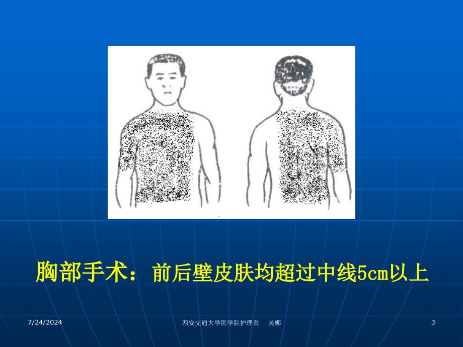 手术区皮肤准备_第3页