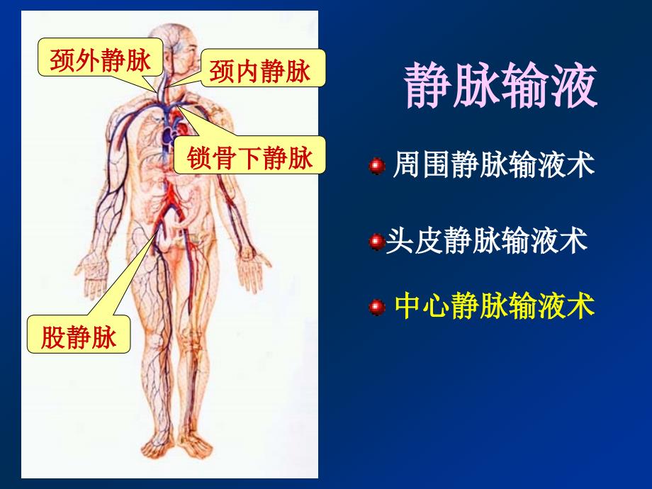 《深静脉输液》PPT课件.ppt_第2页