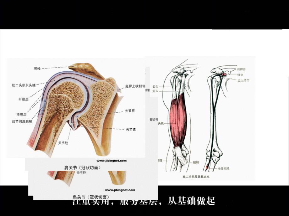 肱二头肌长头肌腱鞘炎课件_第4页