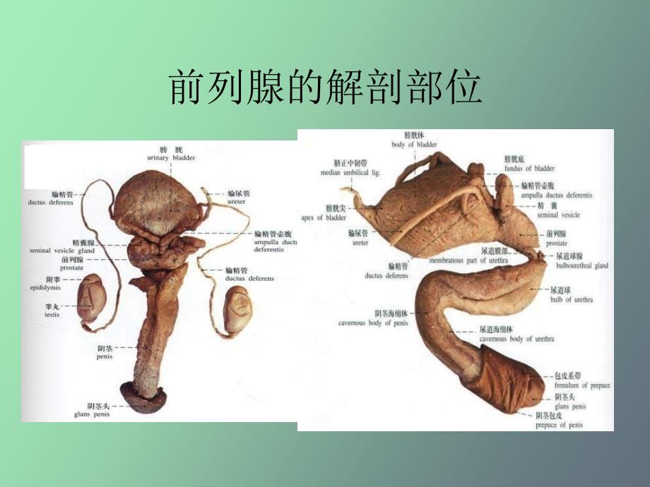 前列腺增生症_第3页