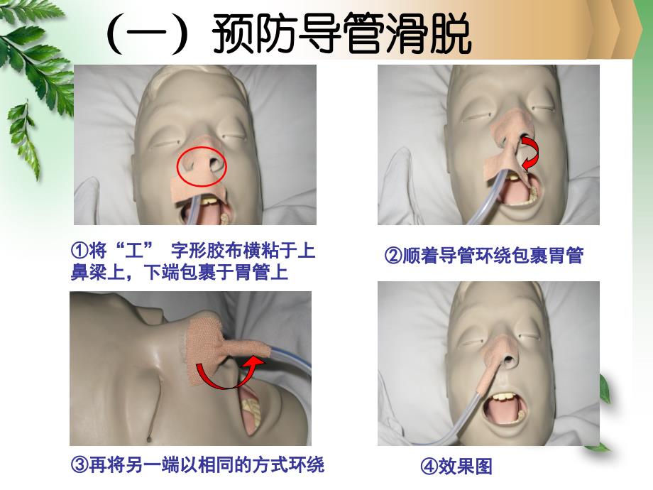 各类导管的护理PPT课件_第4页