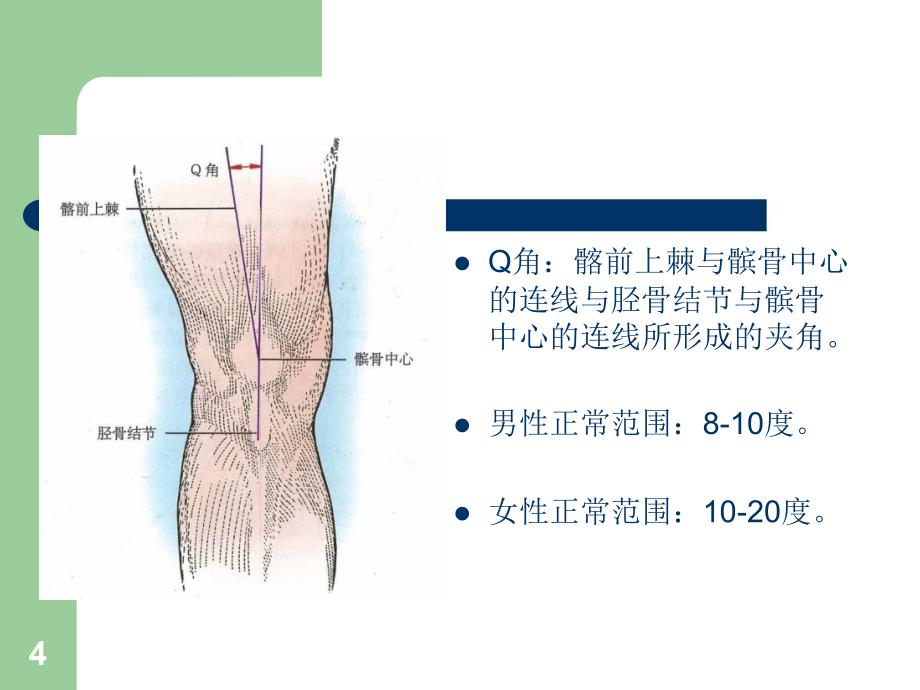 习惯性髌骨脱位ppt课件_第4页