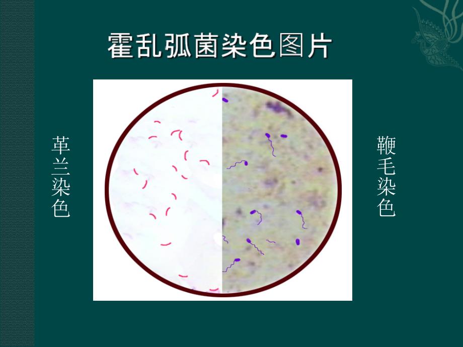 霍乱弧菌检测_第4页