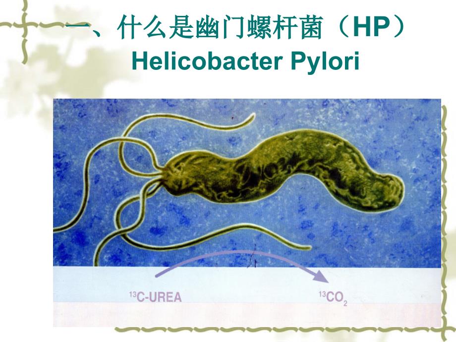 尿13c呼气试验 ppt课件_第3页