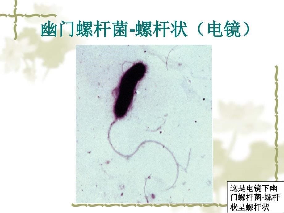 尿13c呼气试验 ppt课件_第5页