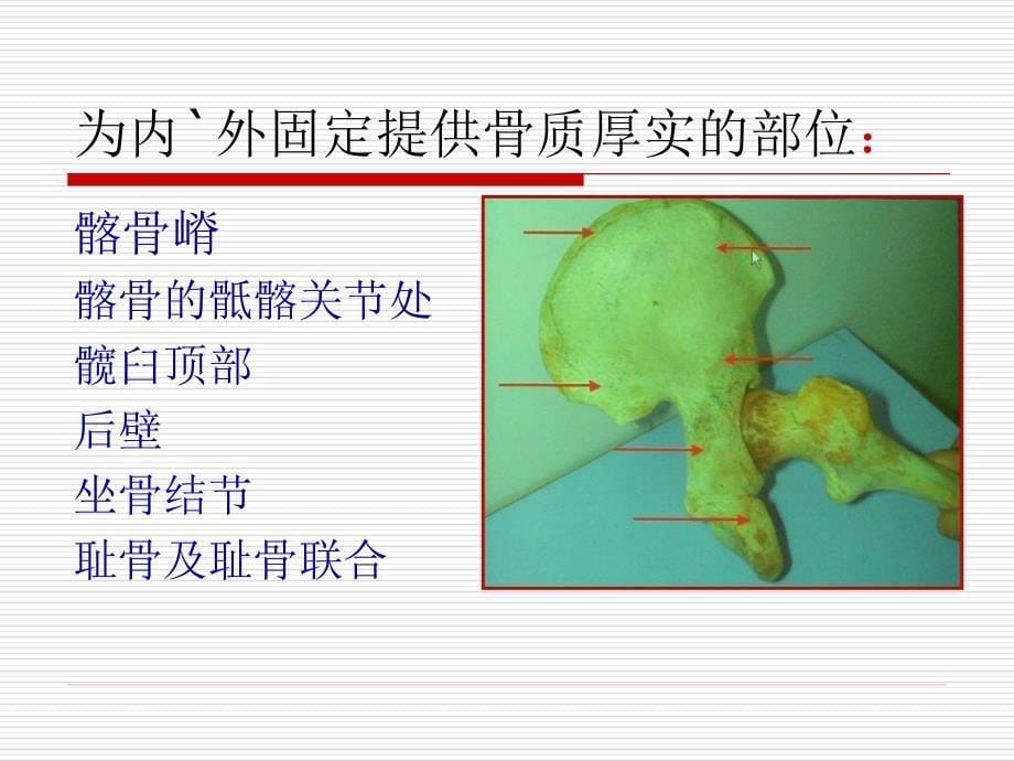 髋臼骨折1128_第5页