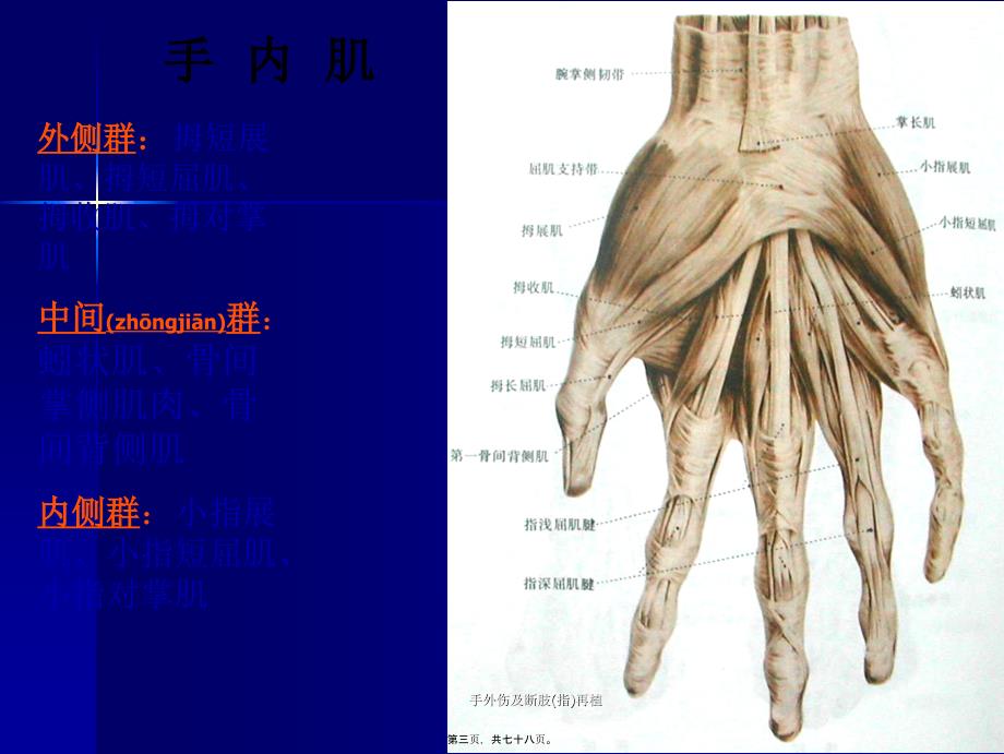 手外伤及断肢(指)再植课件_第3页