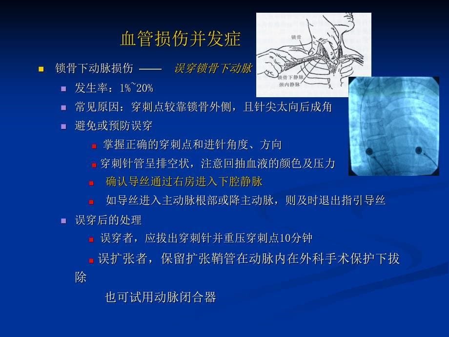 射频消融术并发症ppt课件_第5页