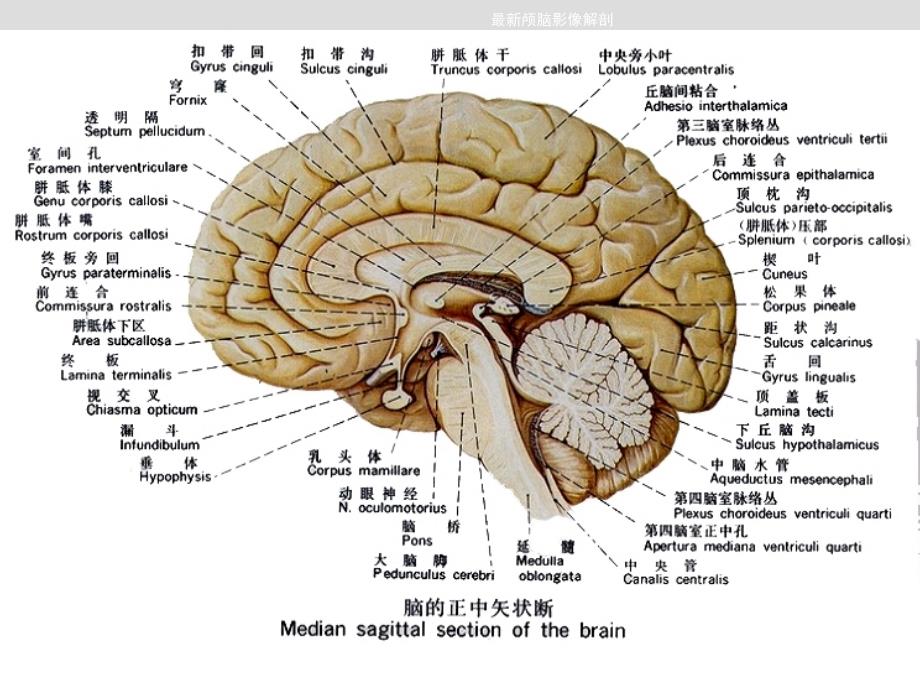 颅脑影像解剖_第3页