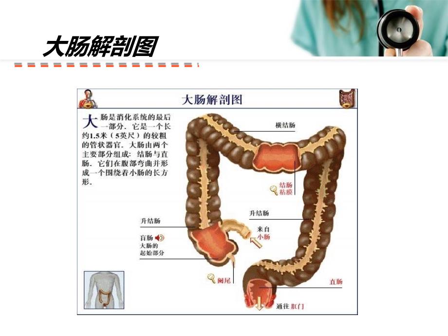 直肠癌ppt课件_第3页