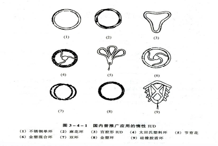 计划生育 ppt课件_第4页