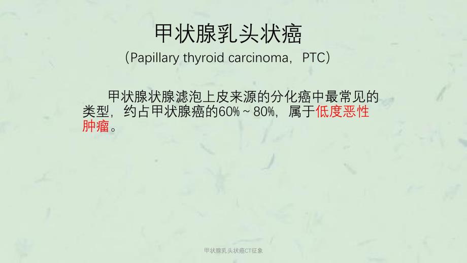 甲状腺乳头状癌CT征象课件_第3页