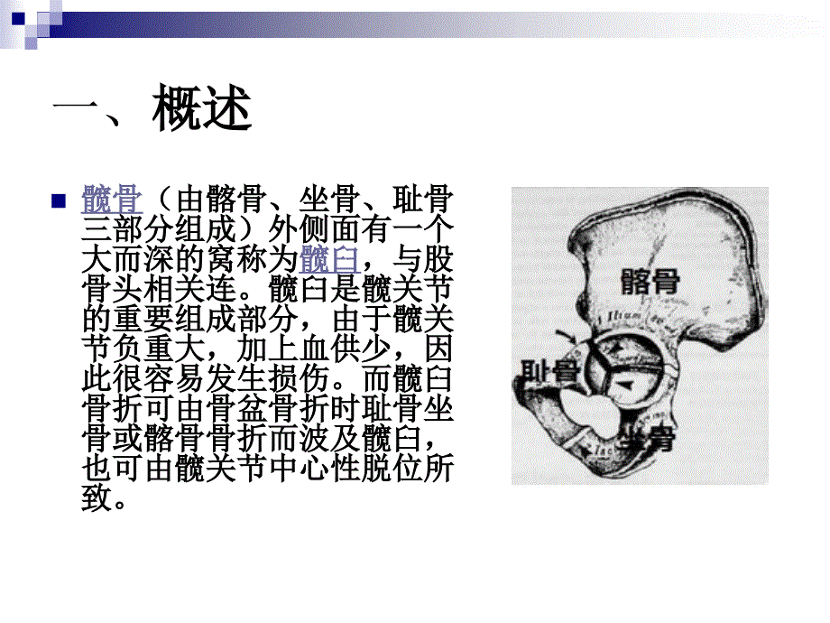 髋臼骨折护理查房_第3页