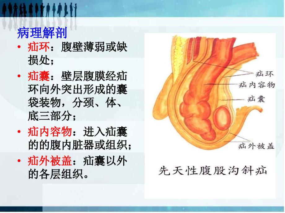 腹外疝病人的护理查房讲义_第4页