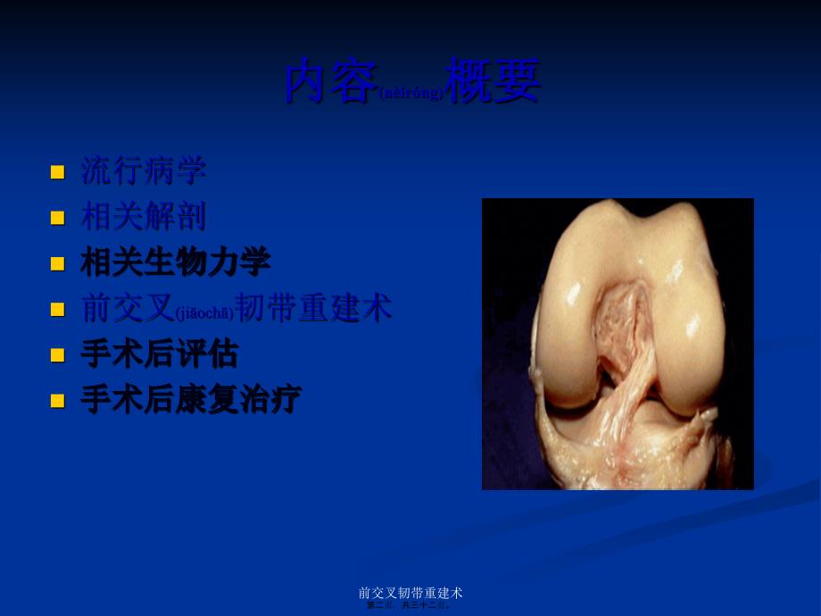 前交叉韧带重建术课件_第2页