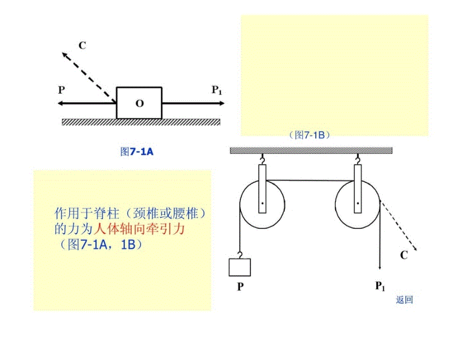 康复治疗7牵引疗法(整理版).ppt_第4页