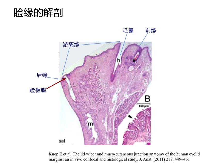 睑缘解剖和睑缘炎病理机理ppt课件_第3页