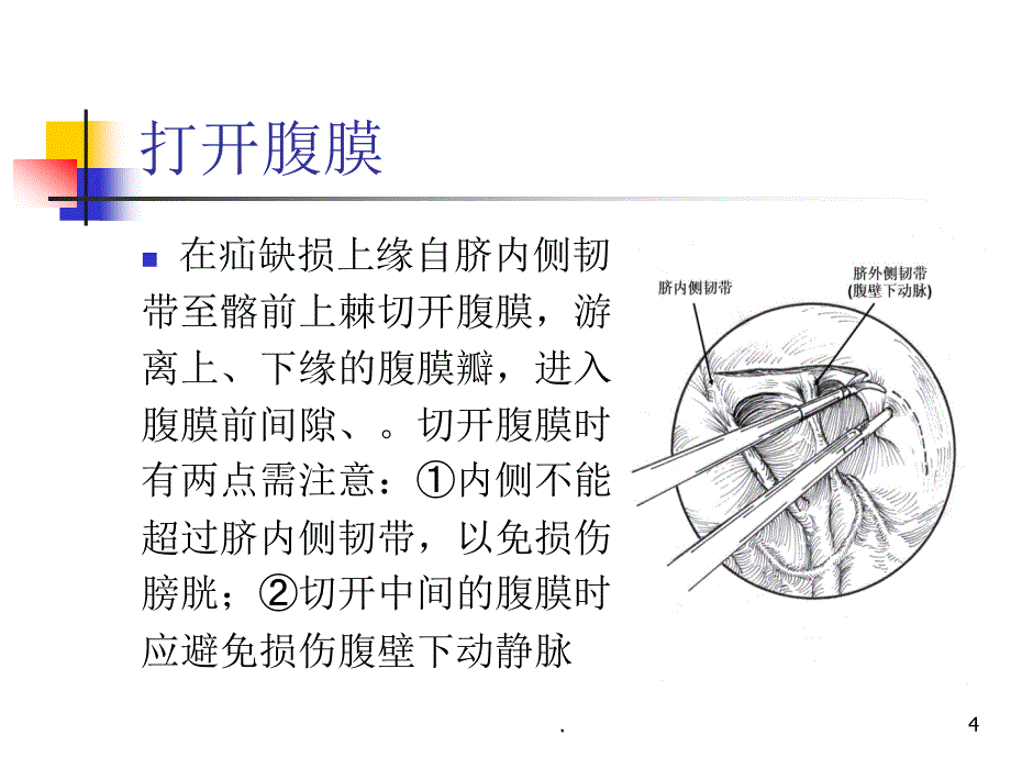 ADR新的、严重的判定评价标准PPT演示课件_第4页