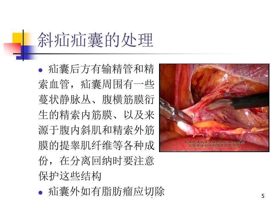 ADR新的、严重的判定评价标准PPT演示课件_第5页