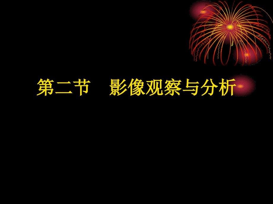 最新医学影像学骨与软组织PPT文档_第5页