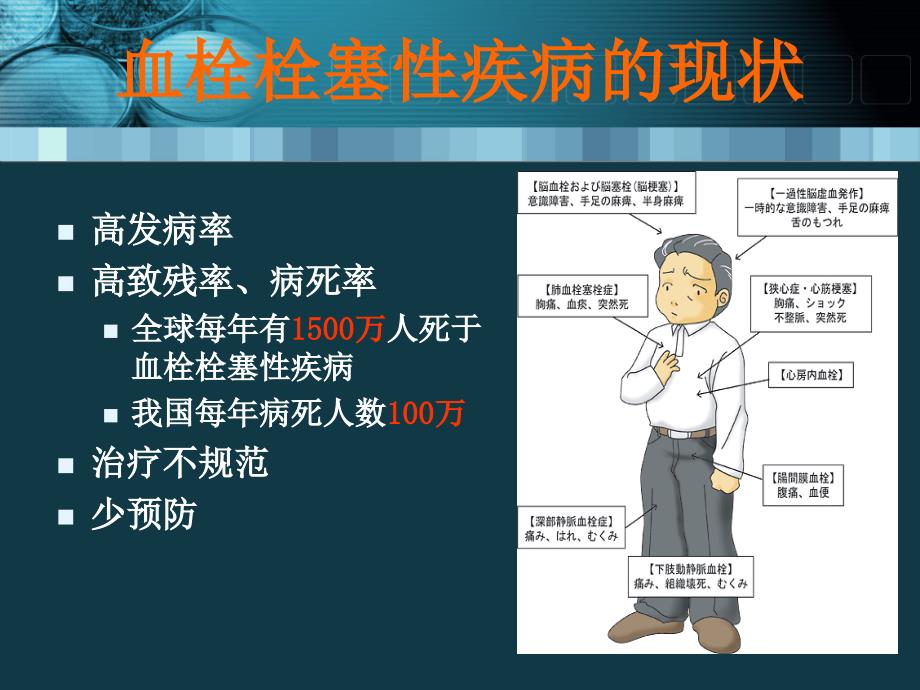 229血栓栓塞性疾病的诊断与治疗(终)数学_第3页