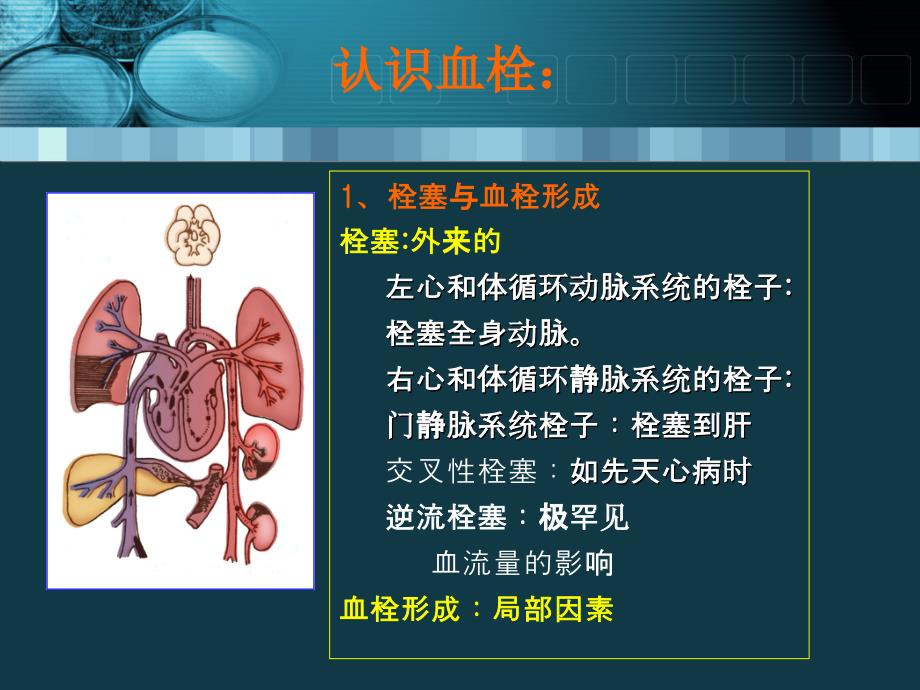 229血栓栓塞性疾病的诊断与治疗(终)数学_第4页