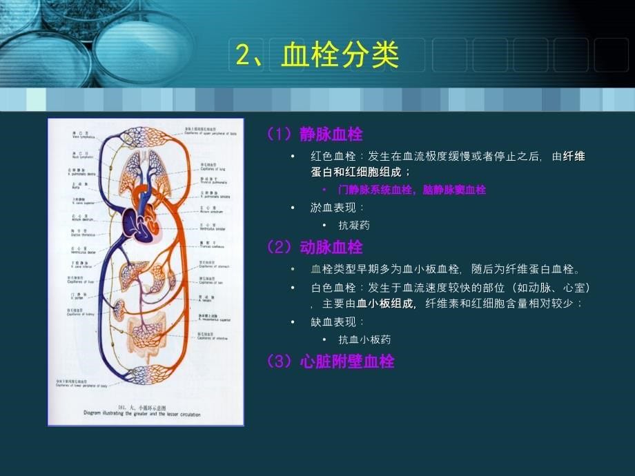 229血栓栓塞性疾病的诊断与治疗(终)数学_第5页