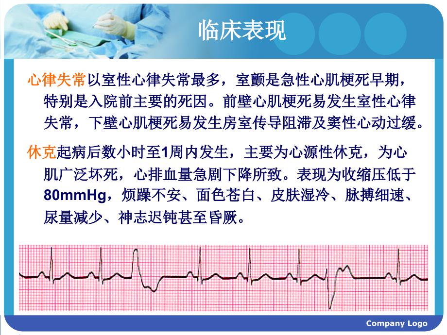 心肌梗塞的护理_第4页