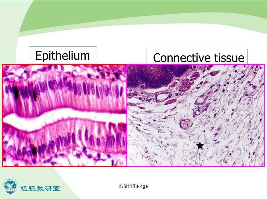 结缔组织PKga课件_第4页